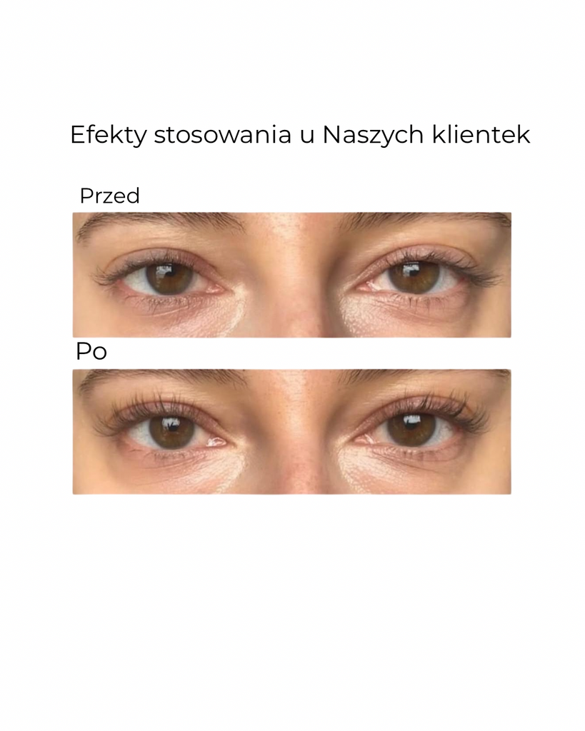 Éleverlash